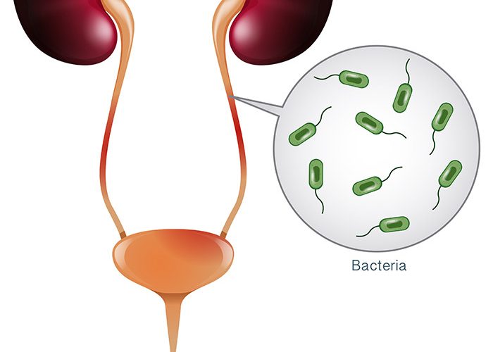 uti disease