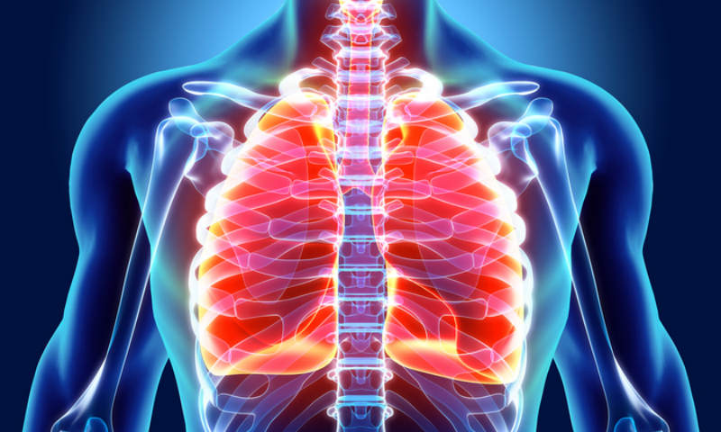 Pulmonary Arterial Hypertension