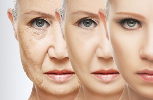 Anti-Aging