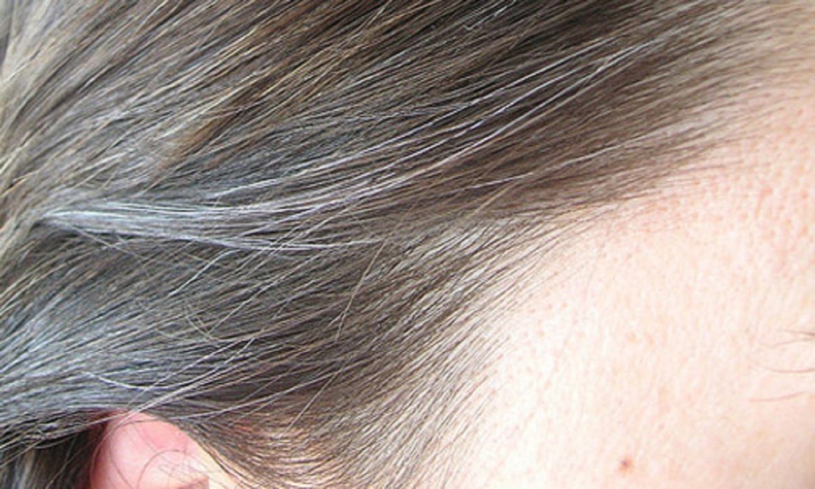 10 Causes Of White Hair And 12 Ways To Prevent It Naturally