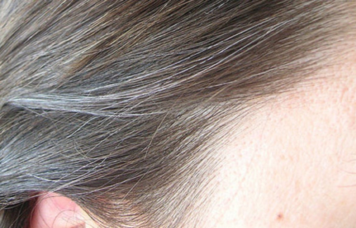 Grey Hair Home Remedies