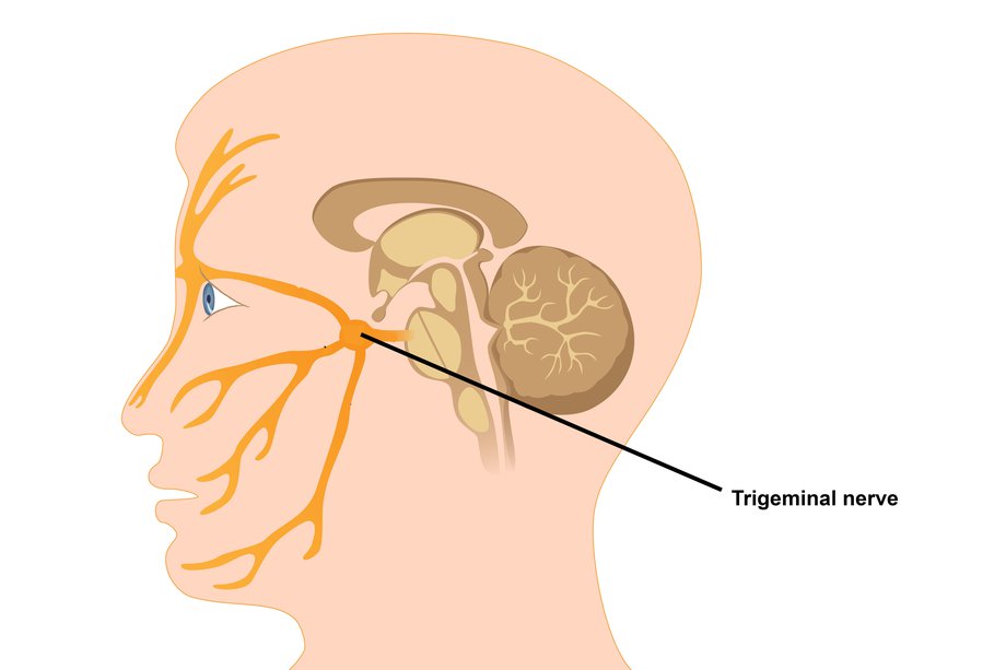 Trigeminal Neuralgia