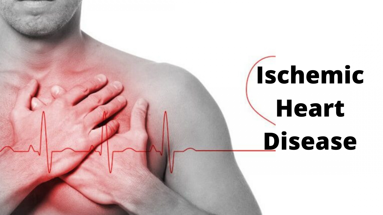 Ischemic Heart Disease Herbal Remedies And Ayurvedic Treatment ischemic-heart-disease-herbal-remedies-and-ayurvedic-treatment
