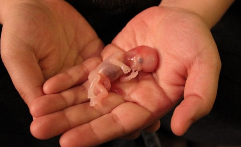 ayurvedic treatment for miscarriage