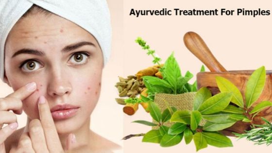 How to cure pimples by ayurvedic medicines