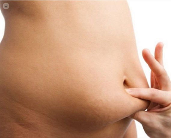 belly fat