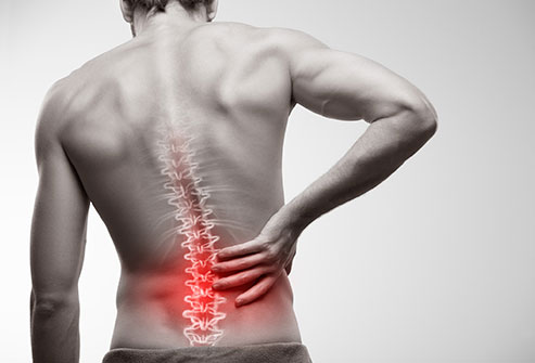 low-back-pain
