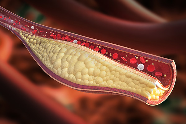 Fibrates