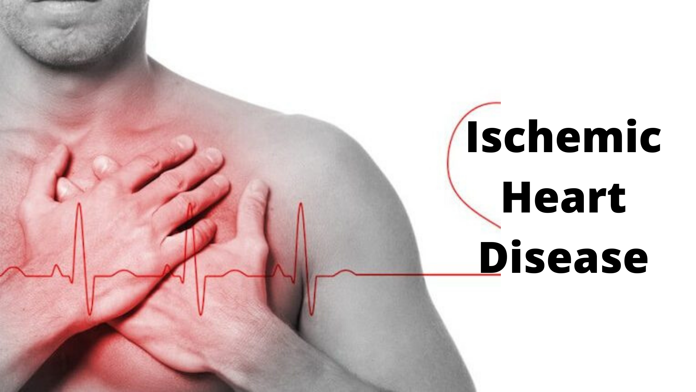 Ischemic Heart Disease