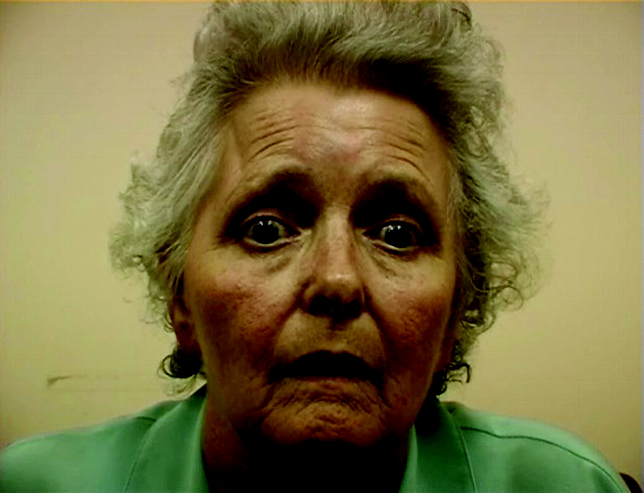 PROGRESSIVE SUPRANUCLEAR PALSY Chandigarh Ayurved & Panchakarma Centre