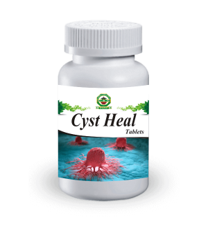 Cyst Heal Tablet