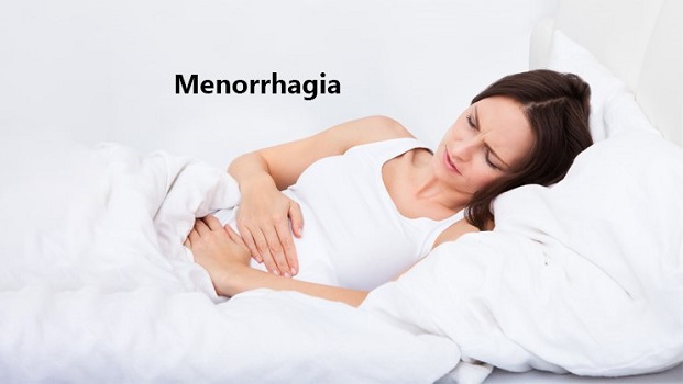 Menorrhagia