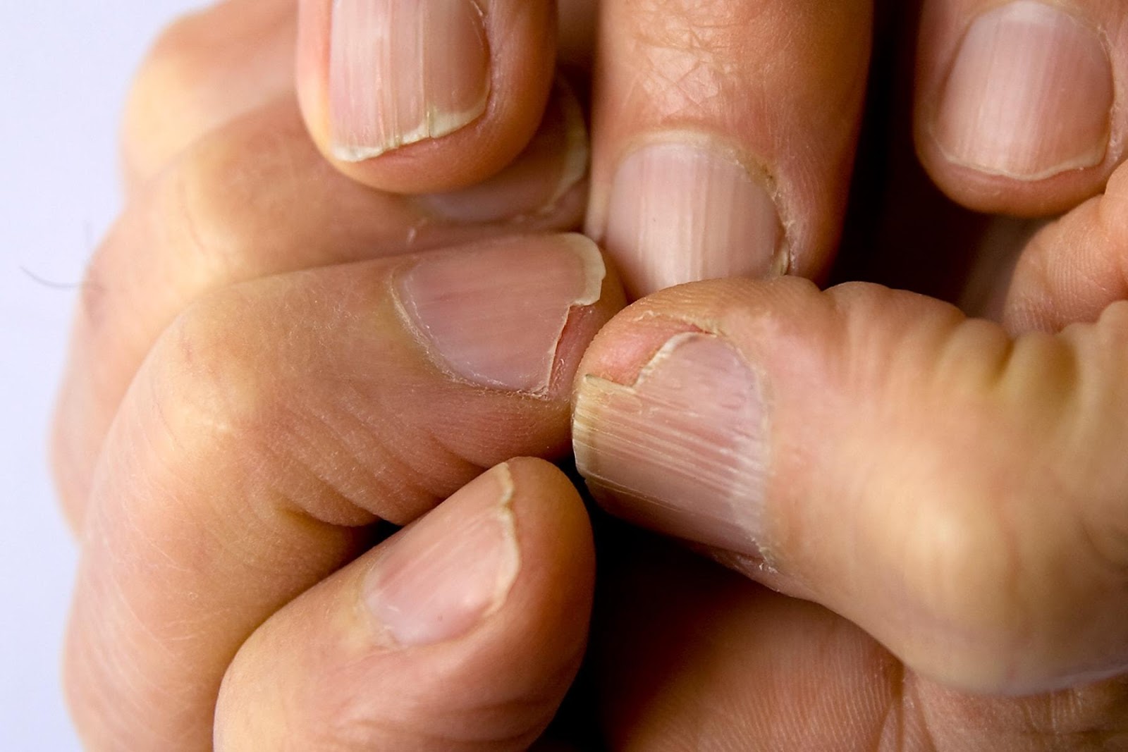 Hot Oil' Manicure Is The Rehab Your Brittle Nails Need