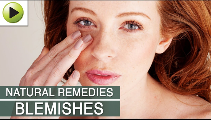 HOW AYURVEDA CAN HELP TO CURE BLEMISHES