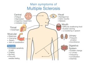 SYMPTOMS OF MULTIPLE SCLEROSIS 