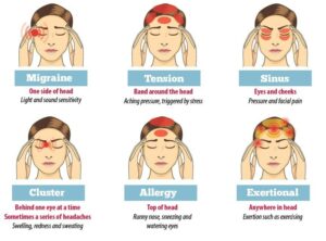 What is headache?