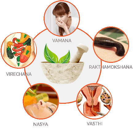 Use of Panchakarma in Incurable Diseases