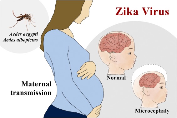 zika virus