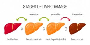 What are liver diseases?