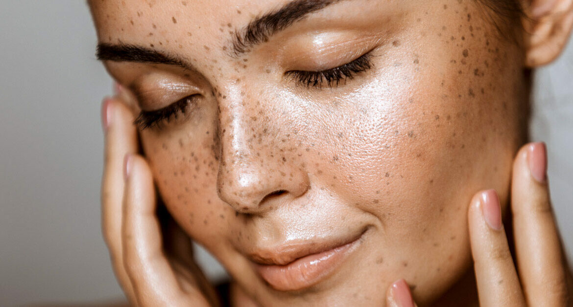 What Are the Most Common Skin Problems?