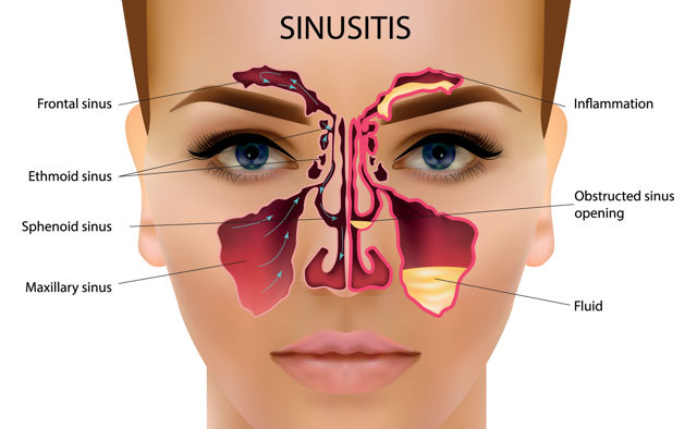 sinus