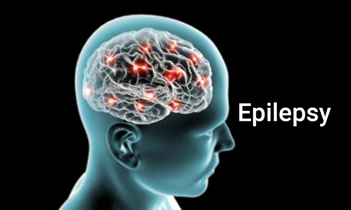 epilepsy