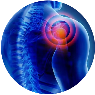 Joint Pain & Arthritis - Action Physiotherapy - Brampton, ON