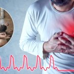 Tachycardia