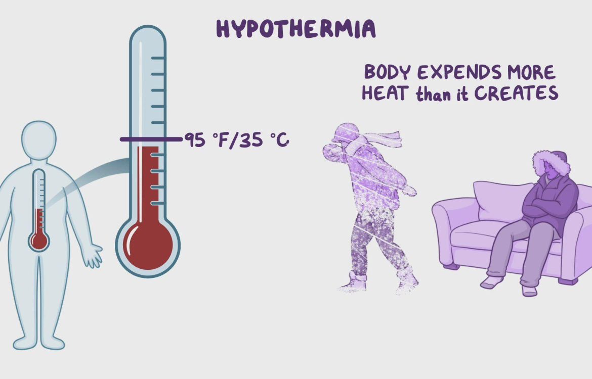 HYPOTHERMIA