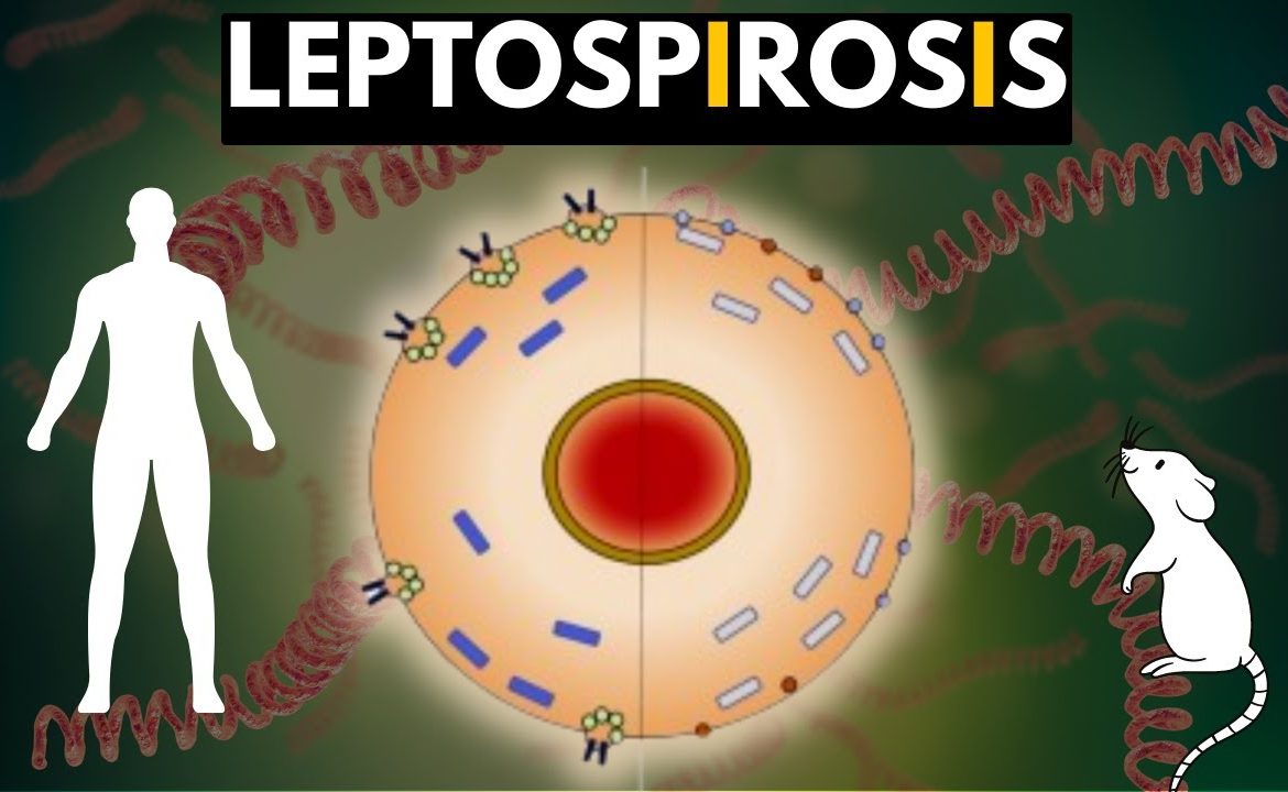 LEPTOSPIROSIS